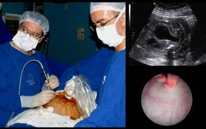 Médicos fazem cirurgia em bebê ainda dentro do útero 
